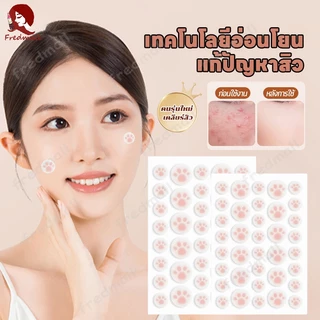 แผ่นสิว สําหรับติดตกแต่งสิว แผ่นแปะดูดสิว แผ่นสติกเกอร์แปะสิว แผ่นดูดสิวน่ารักอุ้งเท้าแมว กันน้ำ
