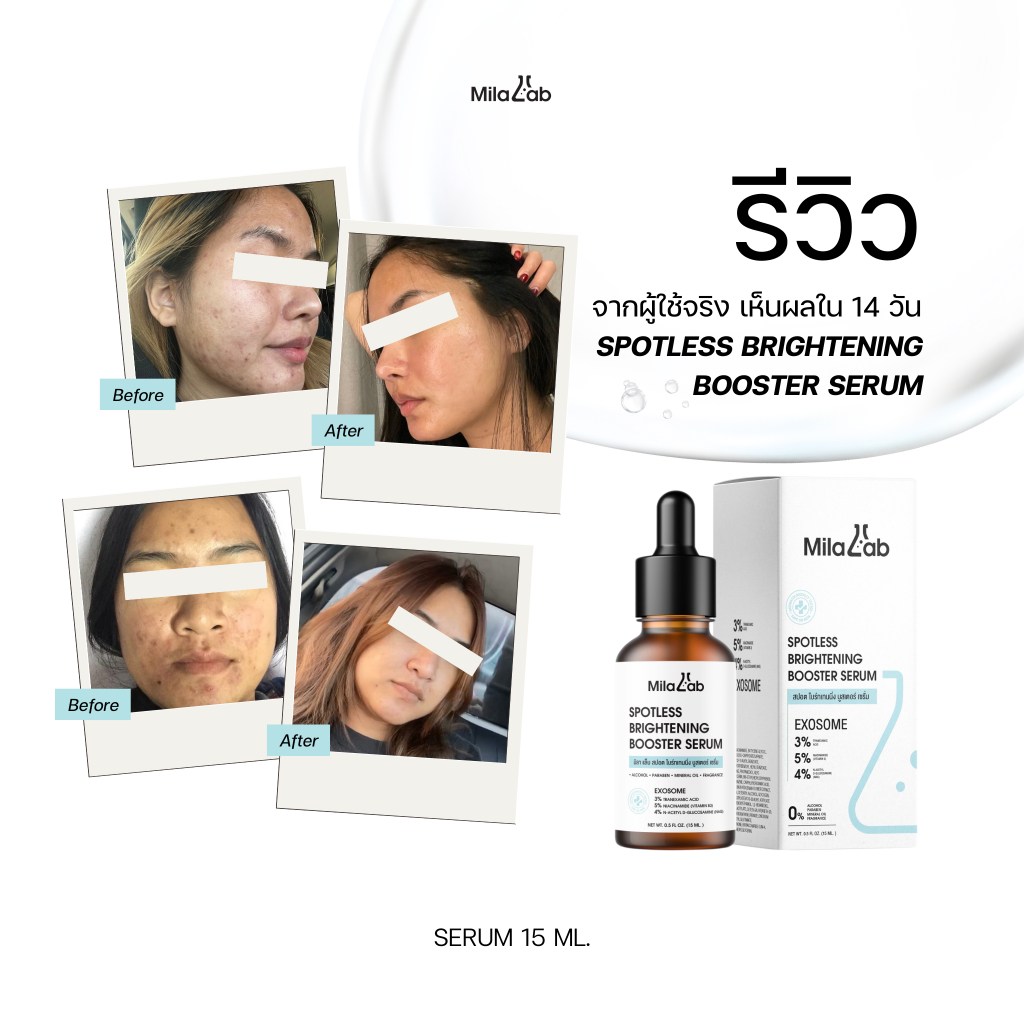 โปร 2 ขวด MilaLab Serum Serum  Spotless Brightening Booster  เซรั่มลดรอย ฝ้า กระ จุดด่างดำ