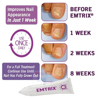 Emtrix fungal nail treatment 10ml