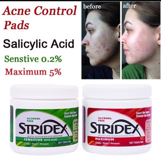 EXP: 01/2024 แผ่นทำความสะอาดผิว Salicylic Acid แผ่นเช็ดลดสิวซาลิไซลิก แอซิด โทนเนอร์ชนิดแผ่น ปราศจากแอลกอฮอล์