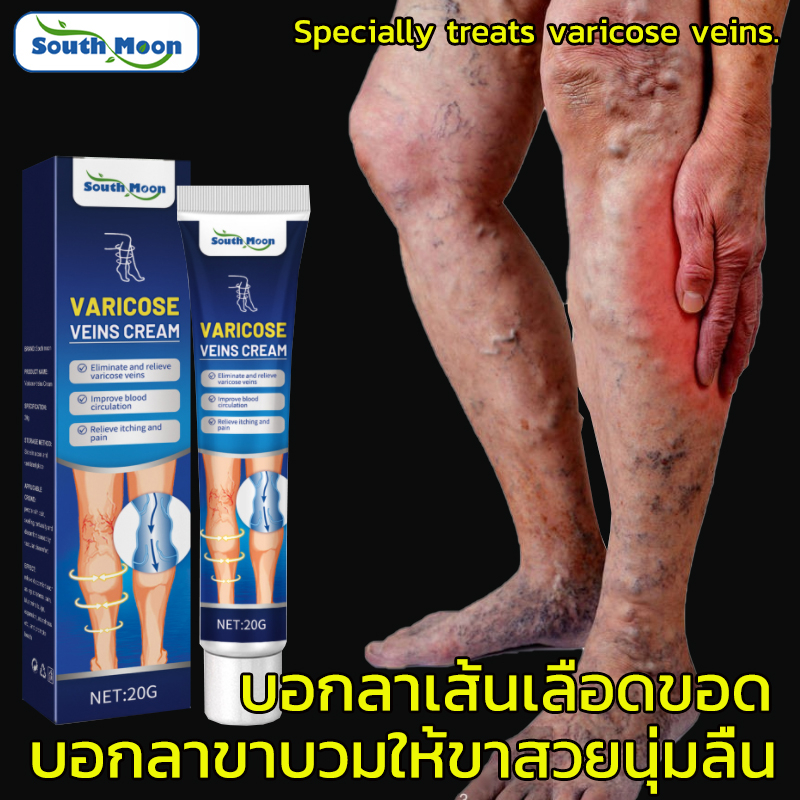แท้100% ครีม ทา เส้นเลือดขอด ของแทั เส้นเลือดฝอยแตก ครีมทาเส้นเลือดขอด เส้นเลือดขอด ส่งเสริมการไหลเวียนโลหิต