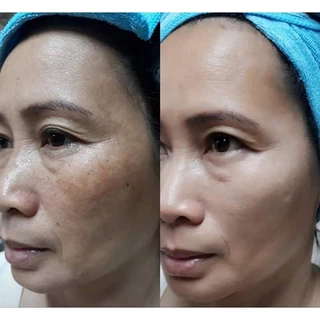 คอลซิลเลอร์เลดี้อายครีม