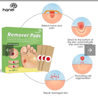 Remover pads พลาสเตอร์แปะตาปลา รักษาตาปลา