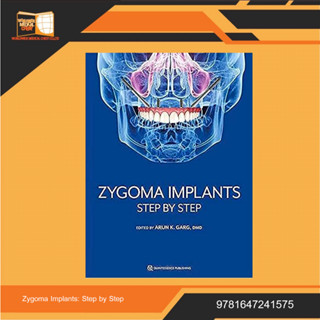 Zygoma Implants: Step by Step 1st Edition