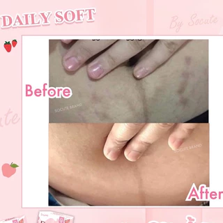 Daily Soft Whitening Soap : เดลี่ซอฟ สบู่ผิวขาวใส ลดสิวหลัง ขนาด 100 g. มี 2 สูตร