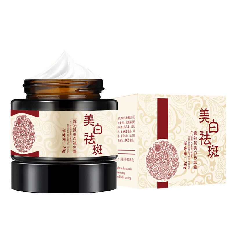 Setiva ไวท์เทนนิ่งครีมลดกระจุดด่างดํา Whitening and Whitening Freckle Cream