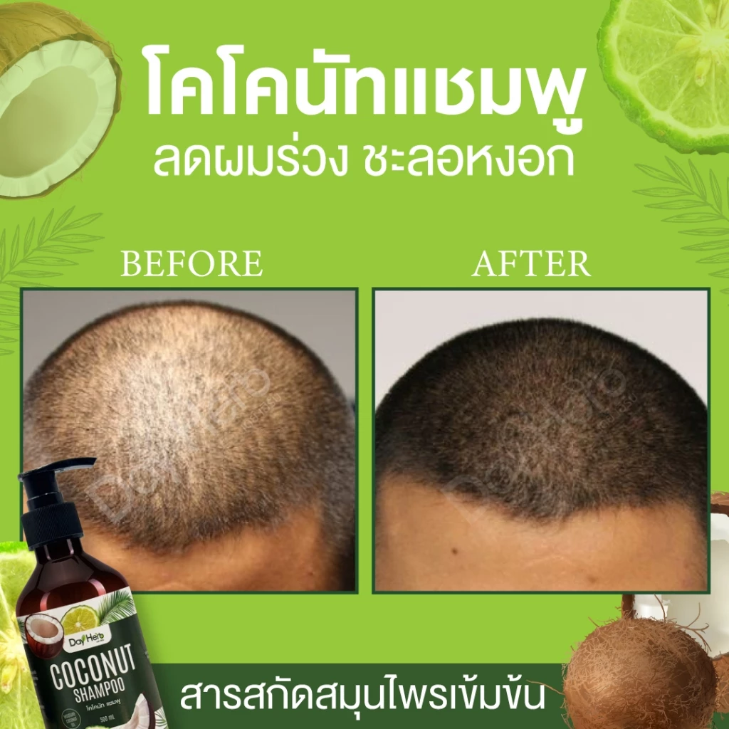 แชมพูมะพร้าว เดย์เฮิร์บ ลด ผมร่วง ผมบาง thumbnail 8