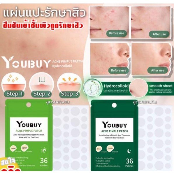 **พร้อมส่งในไทย**แผ่นแปะหัวสิว Youbuy acne pimple patch ช่วยรักษาสิวดูดซับหัวสิวให้แห้งและหยุบไวขึ้น