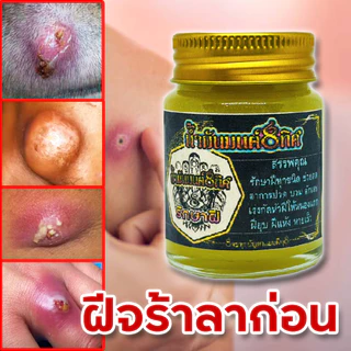โปร 1 แถม 1 ซื้อเลย ชุดกำจัดฝีทุกชนิดครีมบาล์มและสบู่ ดูแลป้องกันเเละยับยั้งฝีหนอ งเนื้อครีมโลชั่นนุ่นเป็นมิตรต่อผิวหนัง
