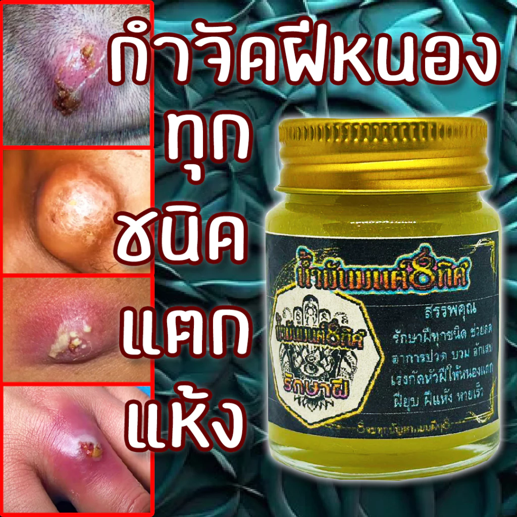 โปร 1 แถม 1 ซื้อเลย ชุดกำจัดฝีทุกชนิดครีมบาล์มและสบู่ ดูแลป้องกันเเละยับยั้งฝีหนอ งเนื้อครีมโลชั่นนุ่นเป็นมิตรต่อผิวหนัง