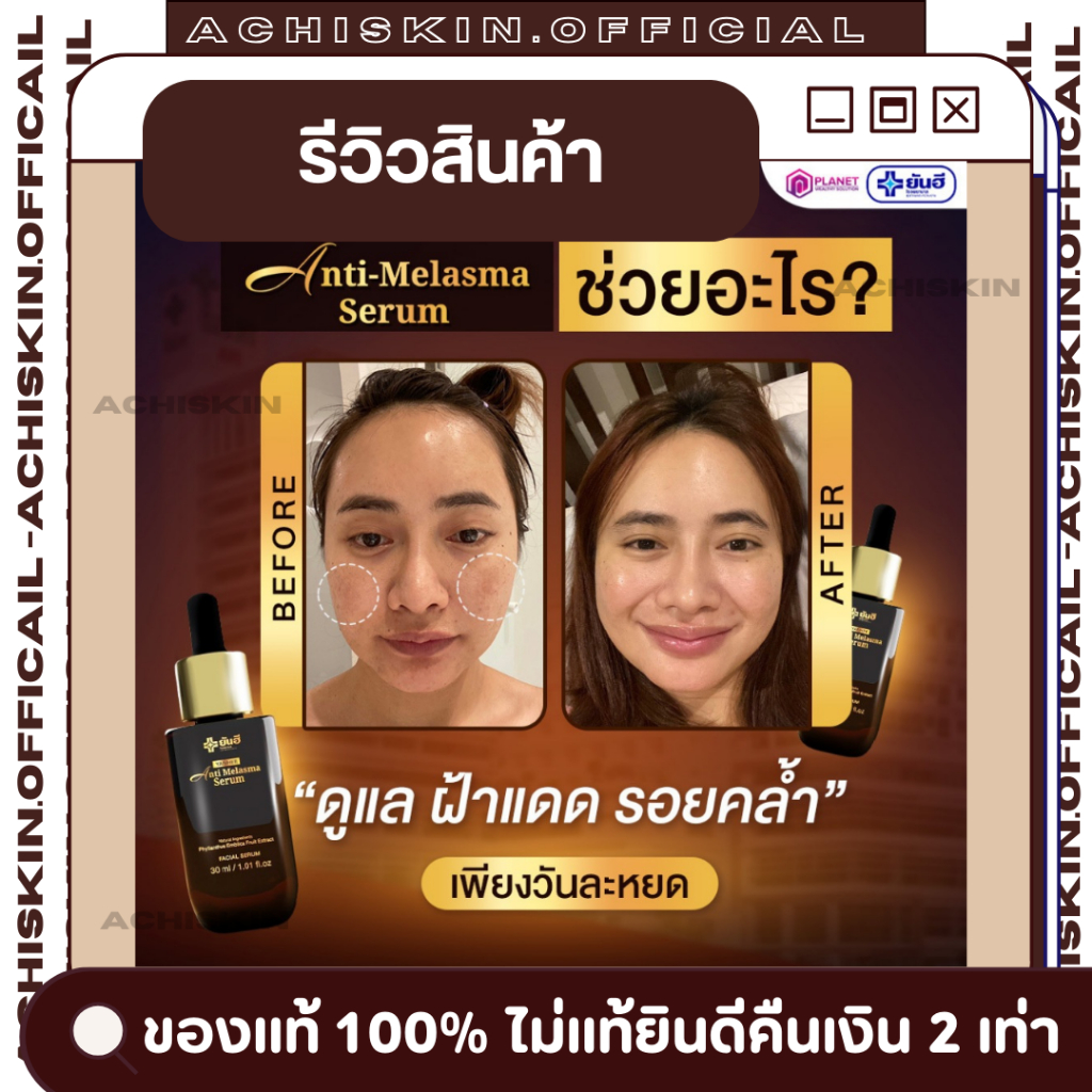 โปรส่งฟรี ⚡[ของแท้ 1,000%] ยันฮี แอนตี้ เมลาสมา เซรั่ม Yanhee Anti Melasma serum - ช่วยลดสิว ฝ้ากระ จุดด่างดำ หน้าไม่บาง