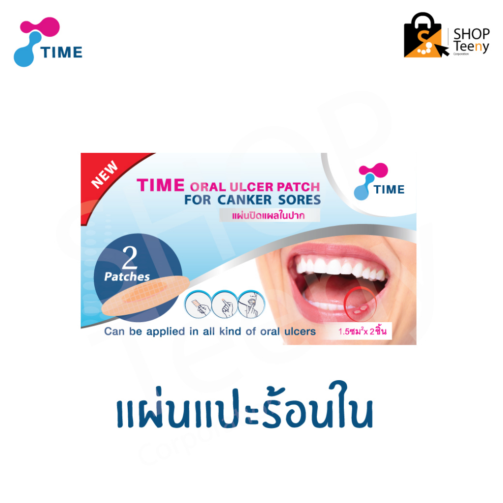 [>ซอง 2/4 ชิ้น<] TIME Oral Ulcer Patch แผ่นแปะแผลร้อนใน แผ่นแปะแผลในปาก
