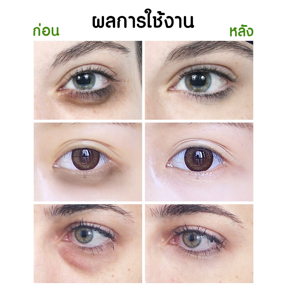 Missnala Aloe Vera Eye Cream อโลเวร่า อายครีม มาร์คใต้ตา ราคา ถูกที่สุด ดีลบีเคเค แกลเลอรีภาพที่ 4