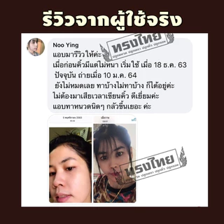 [ ปลูก2แถม2ขวด ]เซรั่มทรงไทย ปลูกคิ้ว ปลูกหนวด ปลูกผม ปลูกขนตา