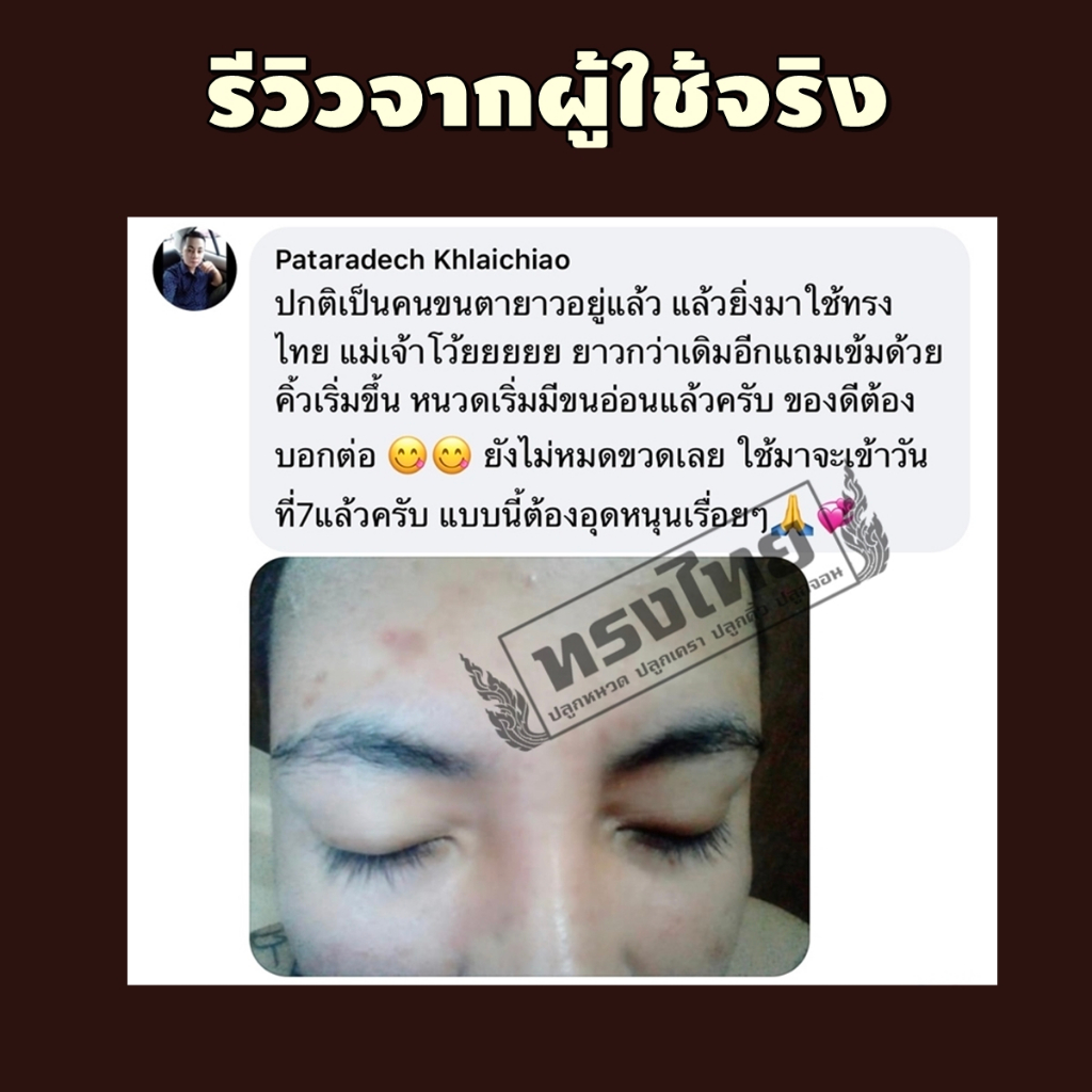 [ ปลูก4แถม4ขวด ] เซรั่มทรงไทย ปลูกคิ้ว ปลูกหนวด ปลูกผม ปลูกขนตา - รูปที่ 4