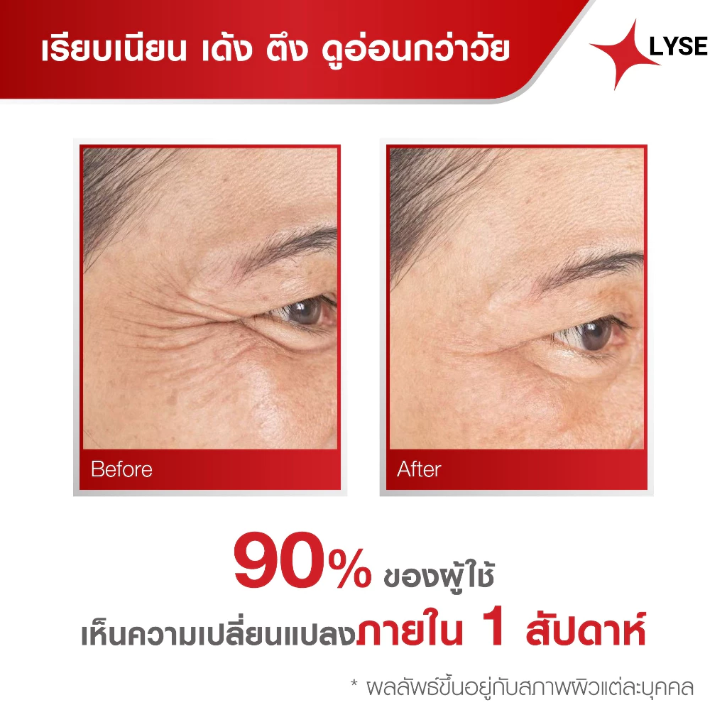 เซรั่มไบร์อัพยกกระชับ 30 กรัม ลิเซ่ LYSE (ตะกร้าตัวเลือก) thumbnail 6