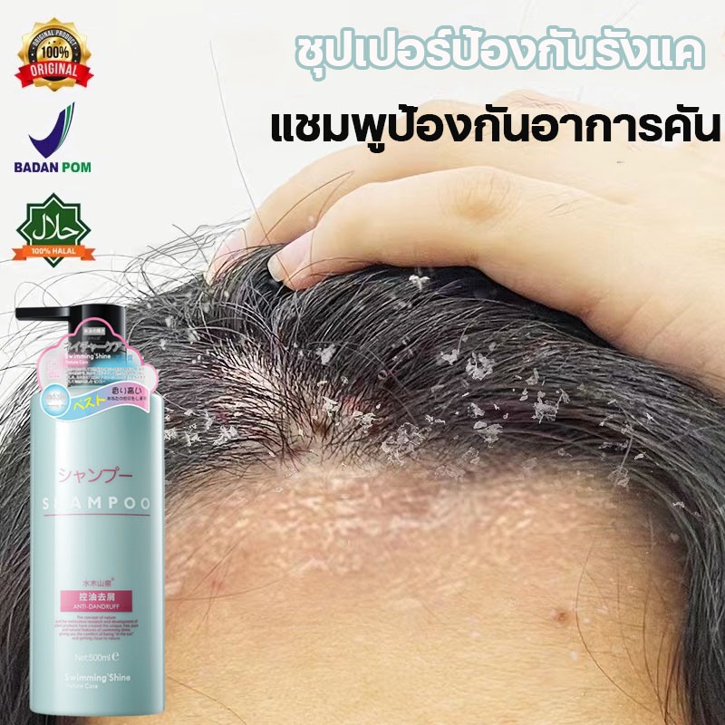 ยาสระผมขจัดรังแค คันหนังศีรษะ ยาสระผมแก้คัน 500ml คนท้องใช้ได้ค่ะ หยุดอาการคัน ยาสระผมเชื้อรา ขจัดรังแค ควบคุมน้ำมัน