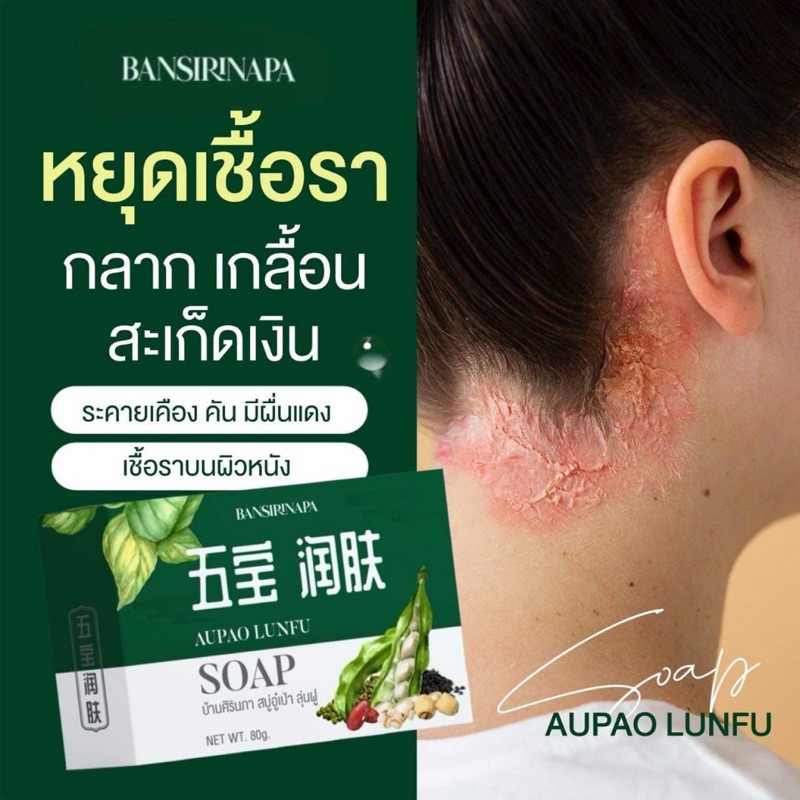 สบู่อู๋เป่า ลู่ฟู่ สบู่ลดอาการคัน ระคายเครืองผิว เชื้อราบนผิวหนัง กลากเกลื่อน