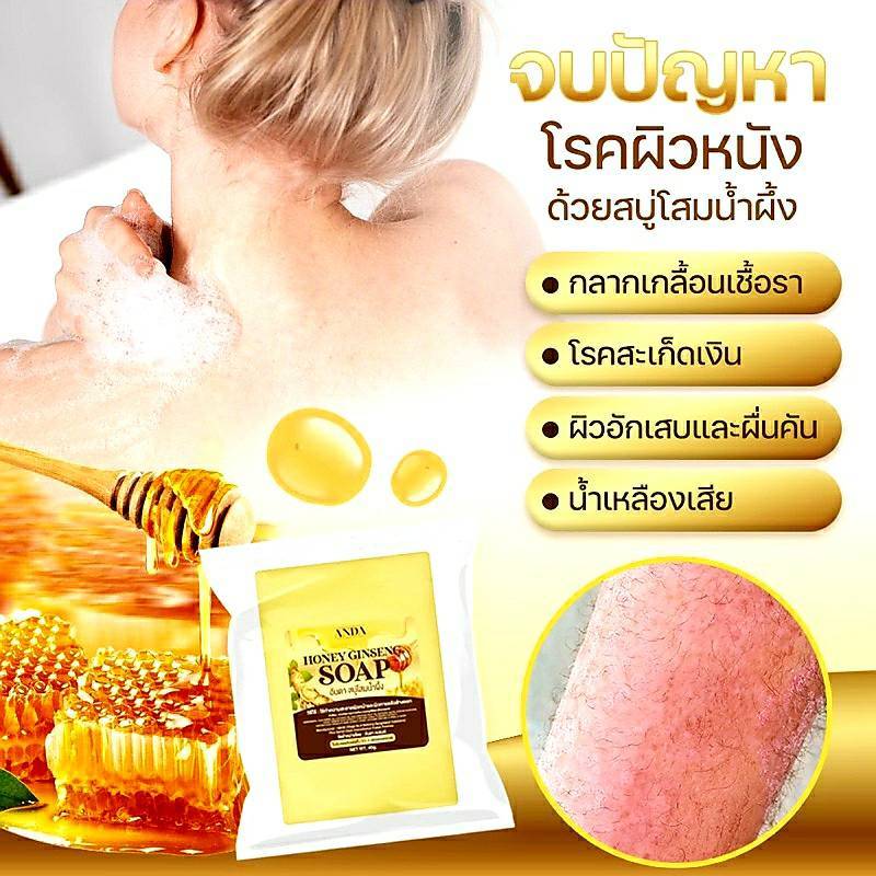 สบู่โสมน้ำผึ้ง ANDA โรคสะเก็ดเงิน โรคผิวหนังคับ กลากเกลื้อน เชื้อรา น้ำเหลืองเสีย มีเก็บเงินปลายทาง