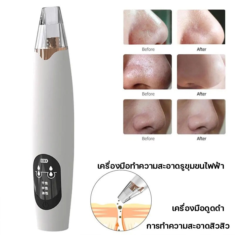 เครื่องดูดสิวไฟฟ้า ปรับระดับได้ ดูดสิวเสี้ยน สิวอุดตัน สิ่งสกปรก สุดคุ้ม! แถมฟรีหัวดูด 3 ชิ้น - รูปที่ 2