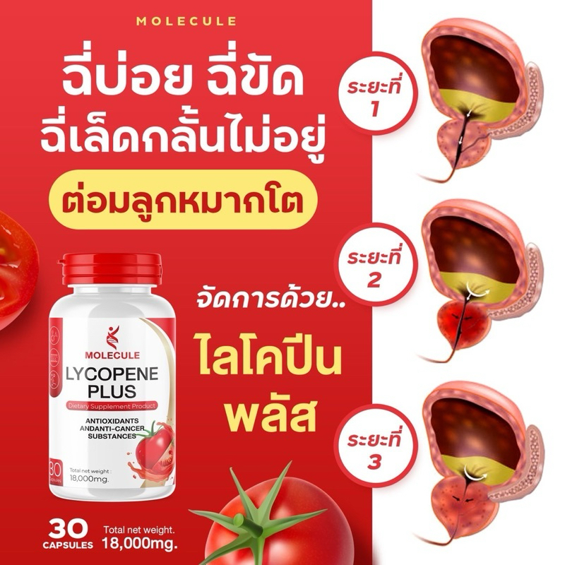 โมเลกุล ไลโคปีนพลัส 1 กระปุก Lycopene ฉี่บ่อยฉี่ขัด กลั้นไม่ได้ ต่อมลูกหมากโต บำรุงสุขภาพ สารสกัดไลโคปีน แบรนด์ Molecule