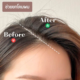 กิ๊บยกโคนผม โรลม้วนผม DIY แบบกิ๊บหนีบ ใช้งานสะดวก ช่วยเพิ่มวอลลุ่มให้ผมดูหนาขึ้น (แพ็ค 1/2 ชิ้น) พร้อมส่ง!!!