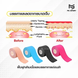 เทปบำบัด *5cmx5m* เทปพยุงกล้ามเนื้อ ไคเนสิโอ คิเนสิโอ Kinesiology Tape Kinesio ส่งไว