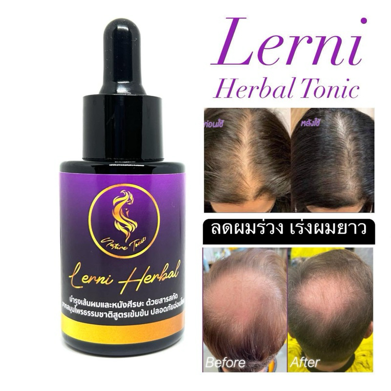 Lerni Herbal Tonic ผมขึ้นเร่งด่วน เลอนี่โทนิคเร่งผมยาว 30ml.