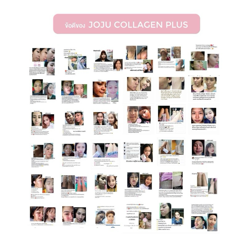[แพคเกจใหม่] โจจู คอลลาเจน JOJU collagen ผิวนุ่มชุ่มชื้น เคล็บลับ “หน้าสวย”  บำรุงเล็บ กระดูก ผม โจจูคอลลาเจน ราคา ถูกที่สุด ดีลบีเคเค แกลเลอรีภาพที่ 8