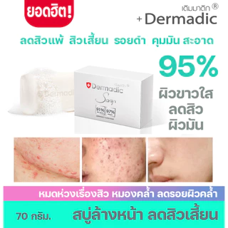 Dermadic เดิมมาดิก สบู่เดิมมาดิก DS ลดสิวหน้าใส ลดสิว พรีเมี่ยมสุดๆ ลืมสบู่ที่เคยใช้ ฮิต!!! ดีมาก การันตรี!!