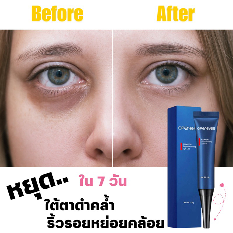 พร้อมส่งจากไทย OPENEYES อายครีม 15g Niacinamide ช่วยลบถุงใต้ตา กระชับผิว ยกกระชับ และลดรอยคล้ำใต้ตา ลดบวมใต้ตา
