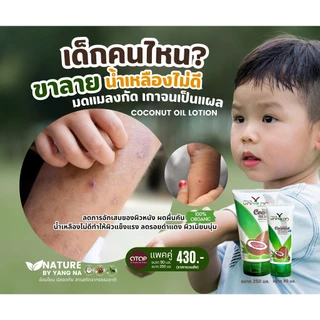"ยางนา" โลชั่นยางนา โลชั่นสำหรับเด็ก ลดผดผื่นคัน ลดรอยแผลที่เกิดจากการเกา