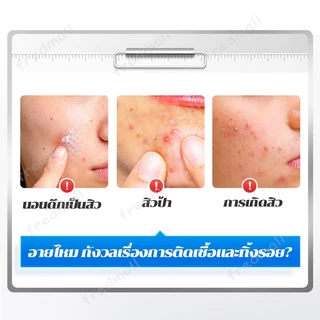 แผ่นแปะสิว แผ่นแปะดูดสิว แผ่นสติกเกอร์แปะสิว แผ่นสิว สําหรับติดตกแต่งสิว 200ชิ้น/ถุง รูปดาวน่ารัก