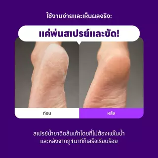 BAREN FOOT EXFOLIANT SOFTENER AT-HOME KIT 100 ML บาเรน ฟุต เอ็กซ์โฟเลียนท์ ซอฟเทนเนอร์ แอท-โฮม คิท