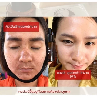 ครีมชาร์มมิ่งสกิน Charming skin (ไนท์ครีมเล็ก ขนาด 10 กรัม) ส่งฟรี