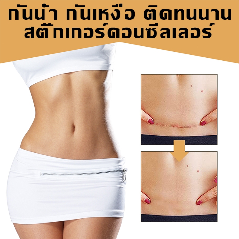 เทปปิดรอยสัก กันน้ํา กันเหงื่อ ติดทนนาน ปกปิดรอยสัก สติ๊กเกอร์คอนซีลเลอร์ เทปปกปิดรอยแผลเป็น พรางรอยแผลเป็นได้เนียนกริบ