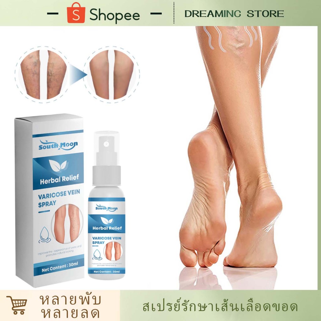 SOUTH MOON สเปรย์รักษาเส้นเลือดขอด 30ml ปรับปรุงการไหลเวียนโลหิต บรรเทาอาการปวดขา ทรีตเมนต์นวดขา