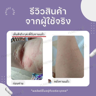 พลูคาวแคปซูล ตราภูรีเฮิร์บ 60 แคปซูล - สมุนไพรผิวหนัง ผื่นคัน (ส่งจาก กรุงเทพฯ)