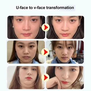 【1แถม1】ผ้ารัดหน้าเรียว ยกกระชับ V Shape ที่รัดหน้าเรียว ลดแก้ม ผ้าดึงหน้ายกกระชับตอนนอนแท้ ใส่นอน ได้เป่าผม
