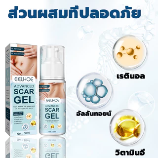 EELHOE ครีมทารอยแผลเป็น50ML รักษารอยแผลเป็น แผลผ่าตัด ทาแผลเป็น ทาแผลเป็นนูน ครีมทาแผลเป็น ครีมลบแผลเป็น