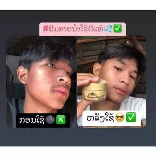 ครีมสายน้ำขนาด30 กรัมใช้ได้นาน 1 เดือนครีมลาว