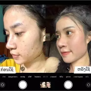 ครีมสายน้ำขนาด30 กรัมใช้ได้นาน 1 เดือนครีมลาว