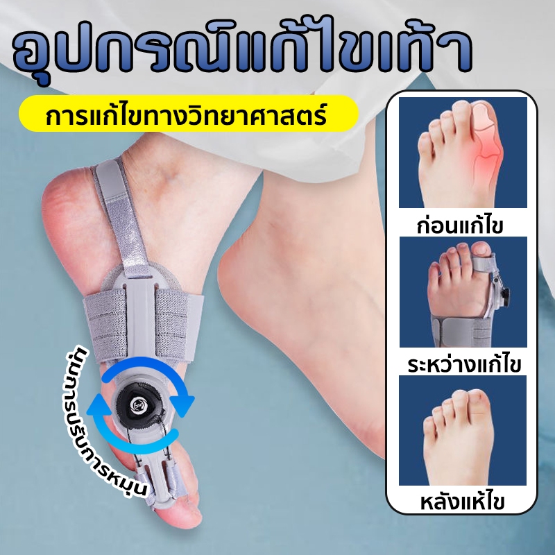 อุปกรณ์แก้ไขเท้า เครื่องแก้ไขนิ้วเท้านำเข้าจาก มุมการปรับการหมุน เหมาะกับความโค้งของกระดูกนิ้วเท้า การอัพเกรดใหม่