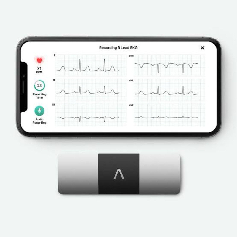 AliveCor KardiaMobile 6L[6 Lead][ของใหม่][พร้อมส่ง]