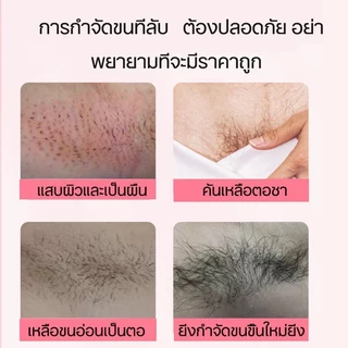 ที่กำจัดขน มูสกำจัดขน ครีมกำจัดขนรักแร้ 100g ครีมซ่อมบำรุงผิว อ่อนโยนไม่เจ็บ ครีมกำจัดขนเร็ว กําจัดขนขา กําจัดขนแขน