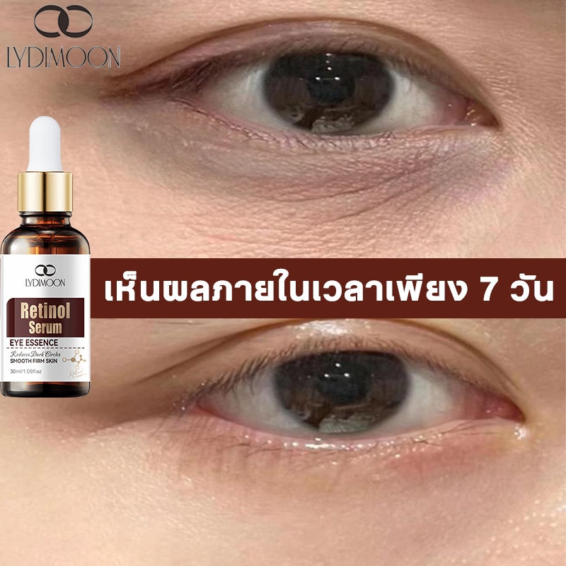 LYDIMOON เรตินอลอายเซรั่ม อายครีม ครีมบำรุงรอบดวงตา ลดถุงใต้ตา ขอบตาดำ ลดเลือนริ้วรอย ลดถุงใต้ ยกกระชับ 30ml