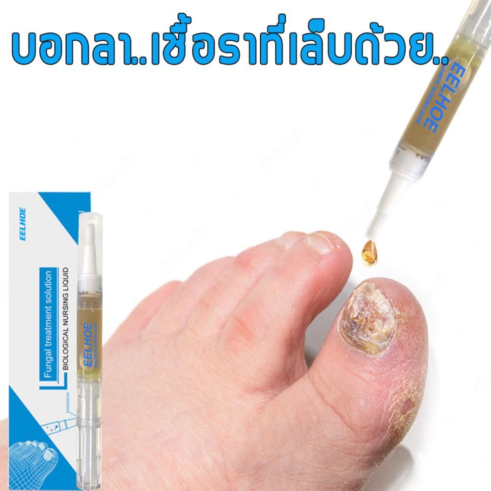 เซรั่มรักษาเล็บ ยาทาเล็บป้องกันเชื้อแบคทีเรีย รักษาโรคเชื้อราที่เล็บ เล็บพัง ดูแลเล็บ เซรั่มซ่อมแซมเล็บ 3 มล