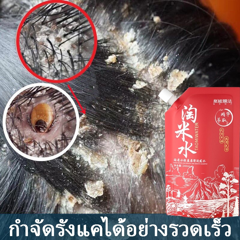 น้ำข้าว แชมพูดูแลเส้นผมบำรุง ควบคุมความมัน ให้ความชุ่มชื้นและเรียบเนียน ทำความสะอาดล้ำลึก ปรับปรุงผมชี้ฟู แชมพู
