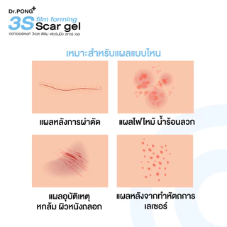 Dr.PONG 3S film forming scar gel เจลซิลิโคนทางการแพทย์ ป้องกันรอยแผลเป็น