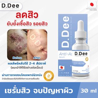 [เซรั่มลดสิว] D.Dee เซรั่มคุณหมอ รีวิวแน่นมาก ลดสิวทุกชนิด ลดรอยสิว ป้องกันการเกิดสิวใหม่ ผ่านการทดสอบโดยแพทย์ผิวหนัง